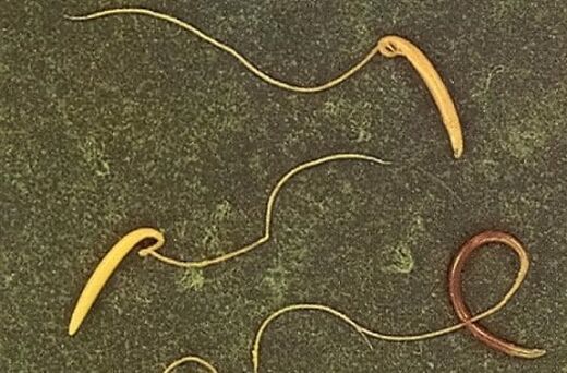 μαστίγιο από το ανθρώπινο σώμα