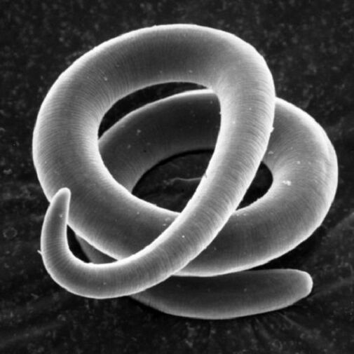 σκουλήκι παράσιτο τριχινέλλα στον άνθρωπο