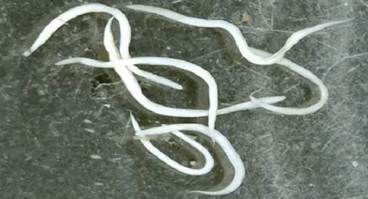 σκουλήκια καρφίτσας στο ανθρώπινο σώμα