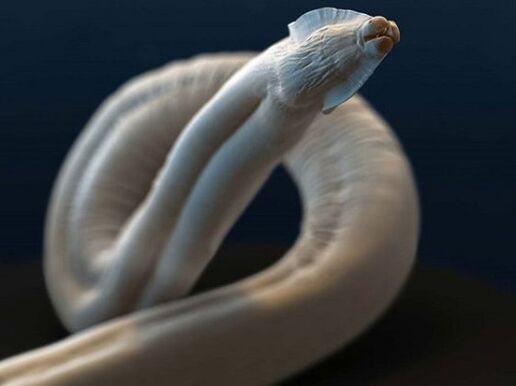 τοξοκάρα από το ανθρώπινο σώμα