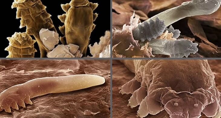 τύπους ανθρώπινων δερματικών παρασίτων