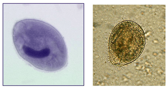 Balantidia ciliates, παρασιτικό στο παχύ έντερο